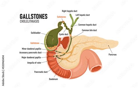 Draining blocked bile ducts